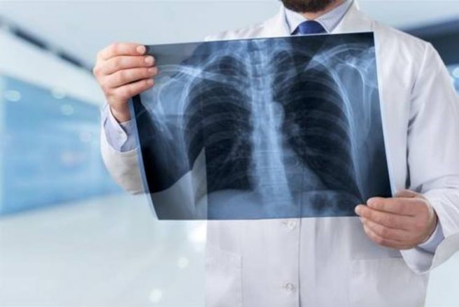 L'homme avait un Playmobil dans les bronches pendant quarante ans. © Shutterstock