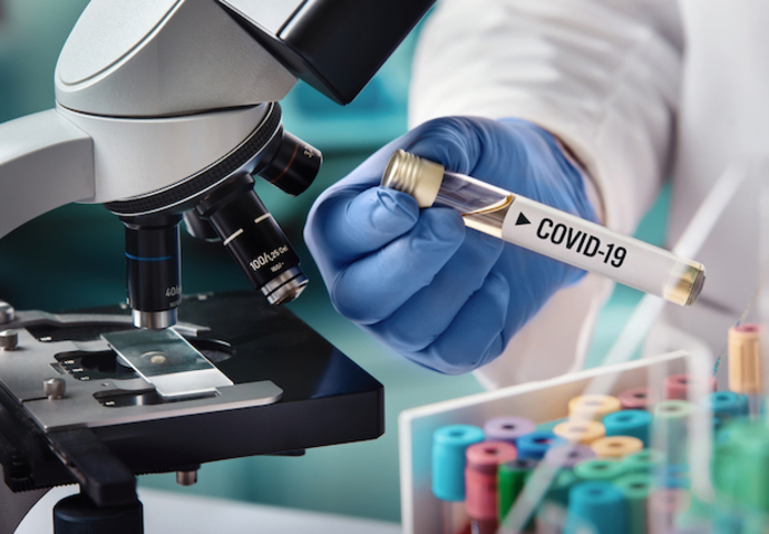 Test coronavirus